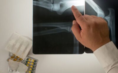 Navigating Income Distribution in Medical Practices