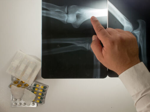 doctor-and-x-ray-508×381